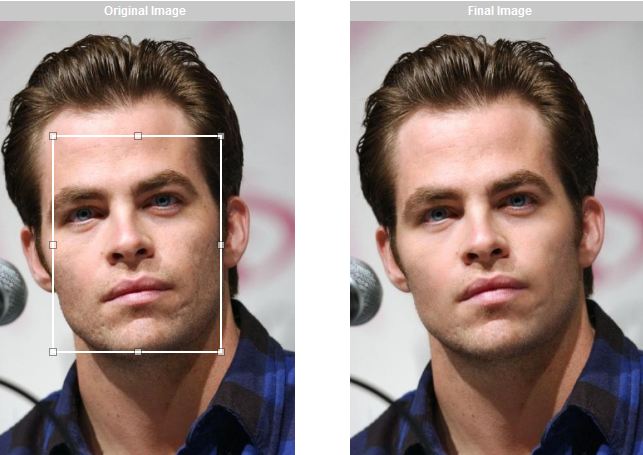 operação plástica cirurgia