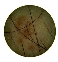 sinal-imagem-macroscopica